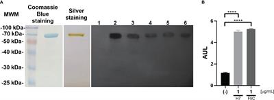 Nasal immunization with H7 flagellin protects mice against hemolytic uremic syndrome secondary to Escherichia coli O157:H7 gastrointestinal infection